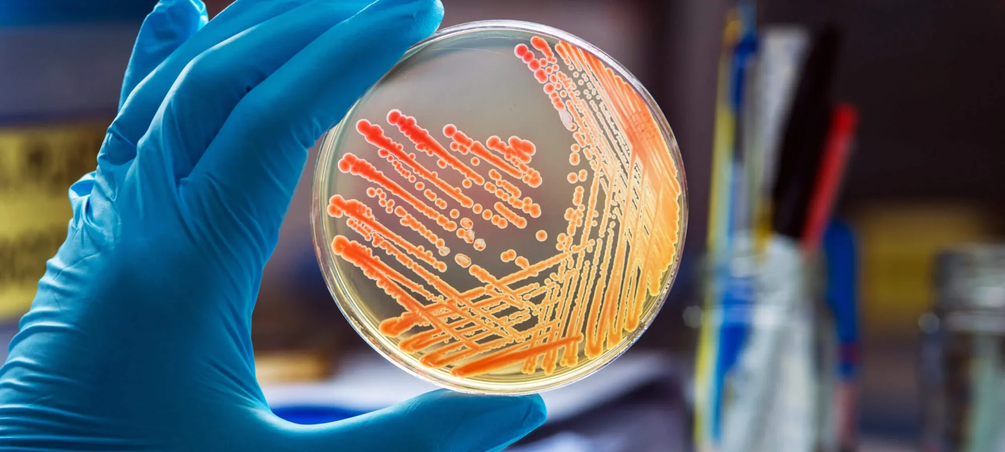 Introduction-to-microbiology-scaled